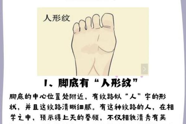 脚上胎记算命，脚底长胎记好不好