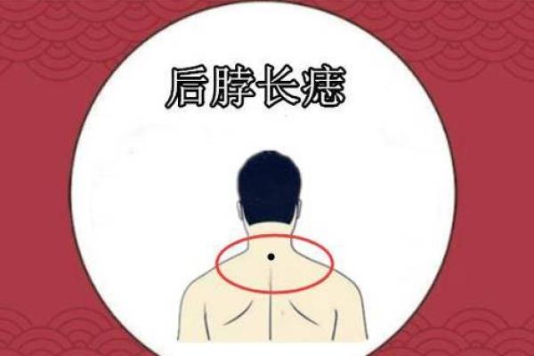 风水上后脑勺长痣代表什么意思