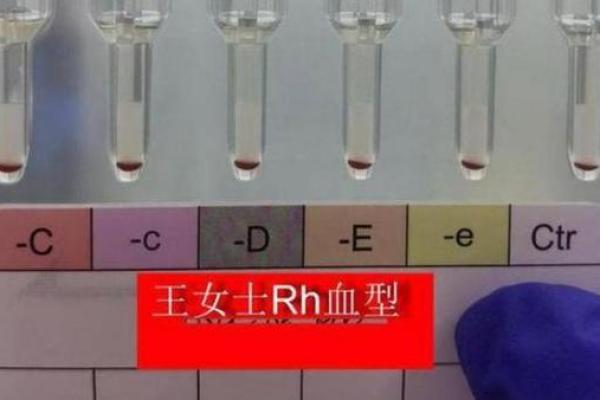 全球100位富豪的血型