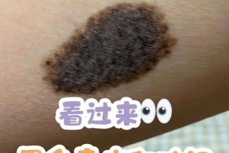 看胎记颜色类型算命