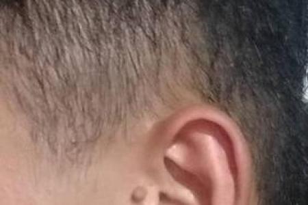 后脑勺有三条竖杠 后脑勺头皮三条竖纹算命