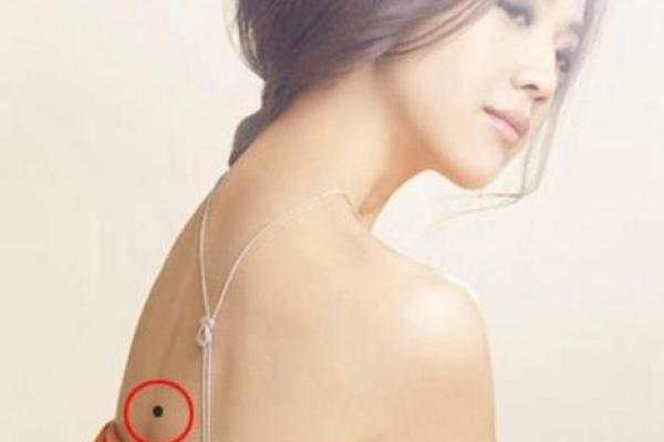 脖子上的胎记如何算命-