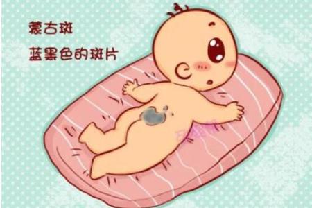 脖子上的胎记如何算命-
