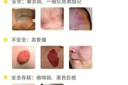 身体上的胎记位置不同算命分析