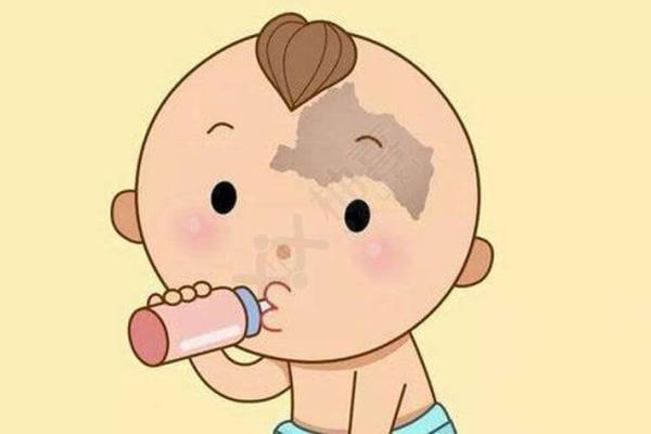 怎么看胎记算命-