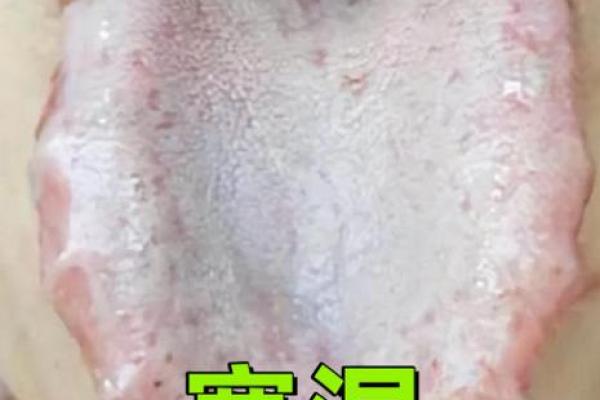 寒湿八字