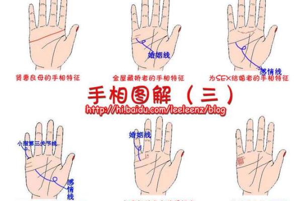 耳朵上的胎记算命分析