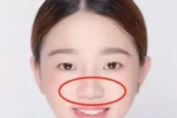 鼻子两侧八字纹图片