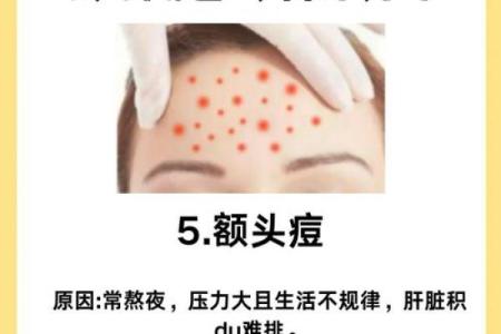 长痘风水学