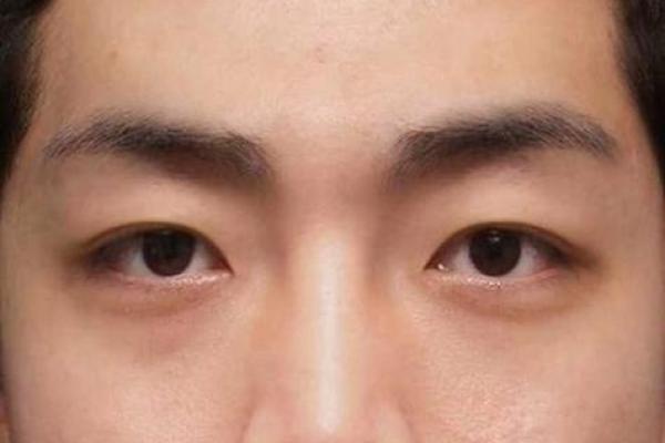 倒八字眼睛