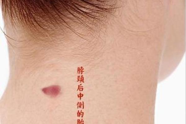屁股上有胎记算命分析