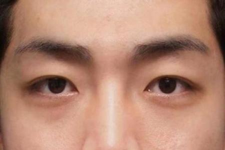 倒八字眼睛