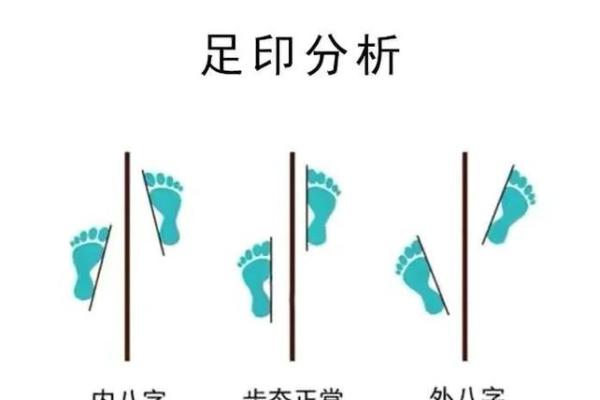 八字脚腿
