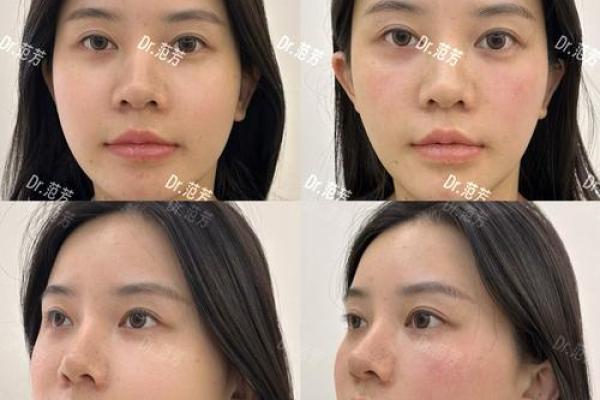 缘分测试脸型整容推荐女生 缘分测试准不准？