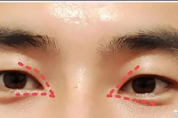 眼角八字