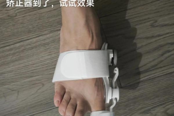 矫正外八字