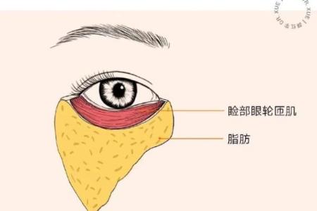 八字眼袋
