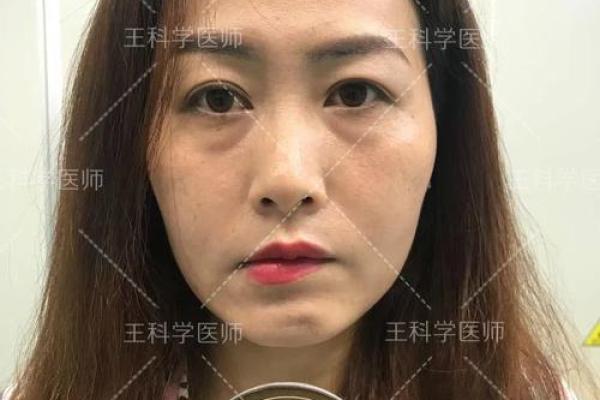 剖腹产看日子 不仅考虑产妇的八字 还要考虑父亲