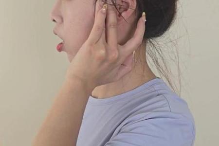 如何优化八字型下巴？