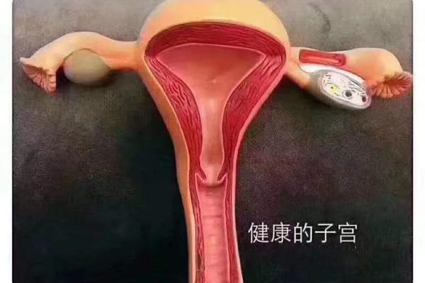 八字火炎土燥不得善终 必无子 怎样缓解