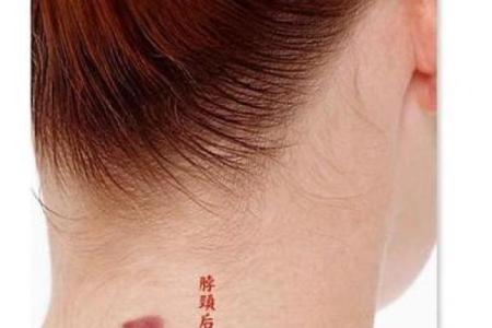 胎记释义，胎记算命中代表什么