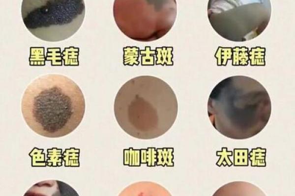 古算命，比较有福气的10处胎记