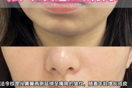 怎么消除八字纹