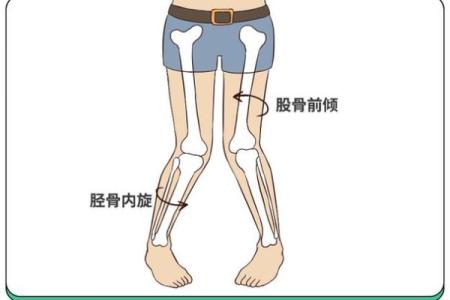 儿童内八字脚