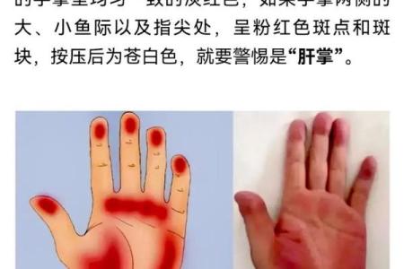 朱砂掌算命，手掌红就是朱砂掌吗？
