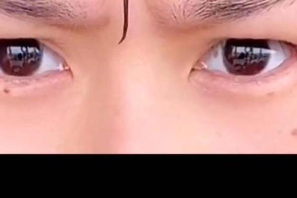 川字纹几种类型，一定要了解清楚：悬针纹、八字纹、双雀纹