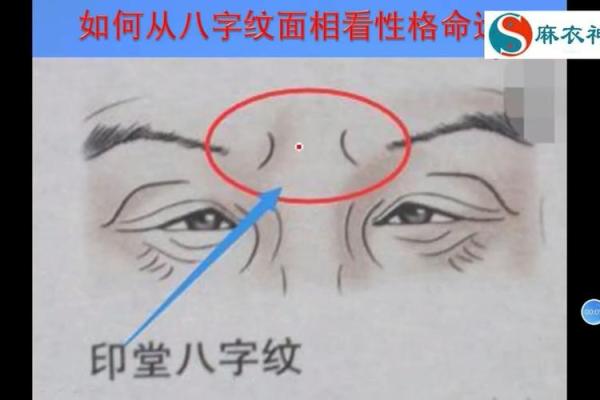 印堂八字纹的男人财运好吗
