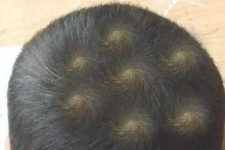 紫薇斗数发旋