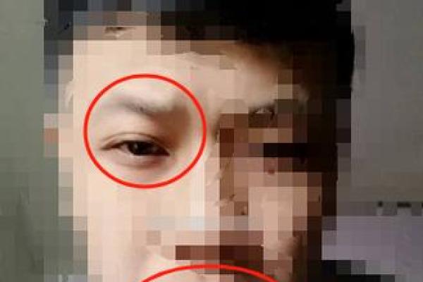 印堂八字纹,男人眉间有八字纹好不好